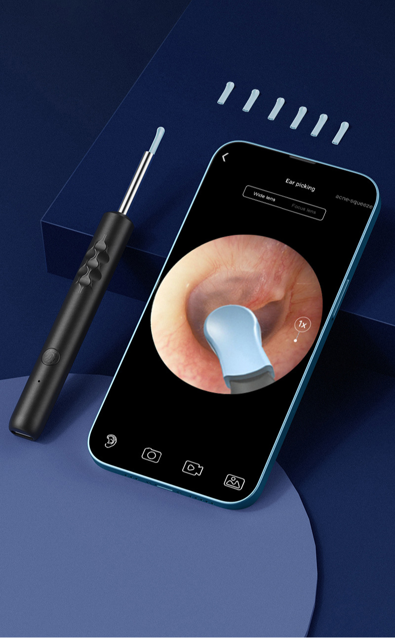 EarScope